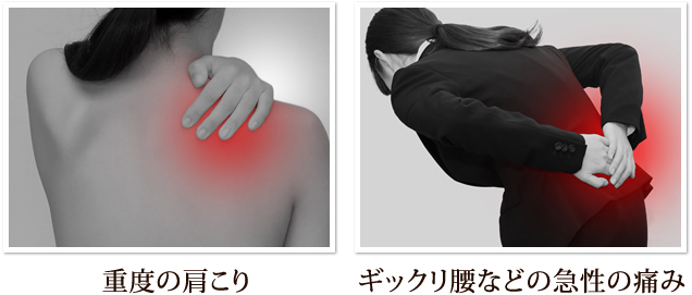 重度の肩こり/ギックリ腰などの急性の痛み
